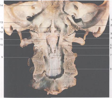288. 颅骨与椎骨的连接(2)-基础医学-医学