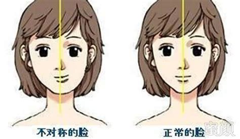 轻微嘴歪图片