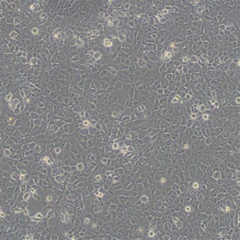 T24细胞_细胞系_科研专用，厂家直发-尚恩生物