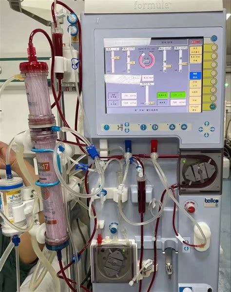 陕西首例|西安医学院一附院开展第三代血液净化新技术「血滤吸附 SupraHFR」-医院汇-丁香园