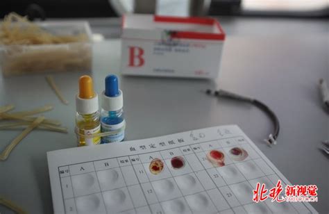 6岁熊猫血女孩急需输血：父亲微博求助 一天8名志愿者自愿献血 | 北晚新视觉