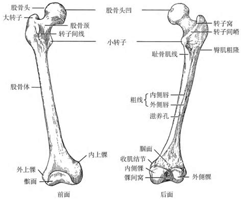 股骨头图片