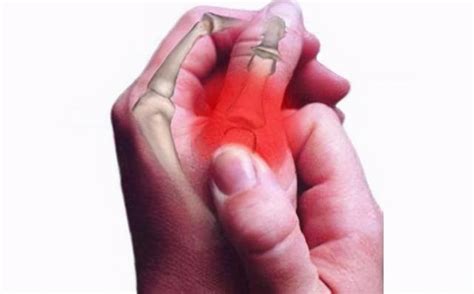 手指关节疼痛是怎么回事？可能与这几个因素有关，别不当回事 - 健康知识 - 轻壹