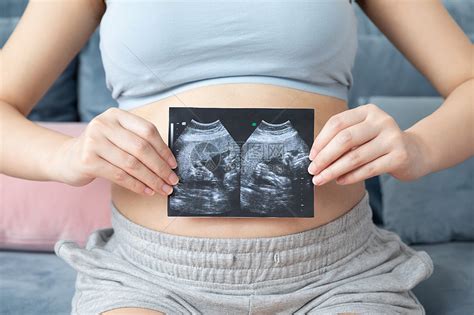 孕妇拿着b超高清图片下载-正版图片501363326-摄图网