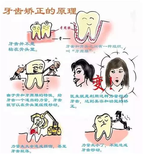 牙齿矫正过程动图图片