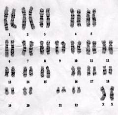是否存在YY染色体人？如果真的存在，TA会是什么样的人类？