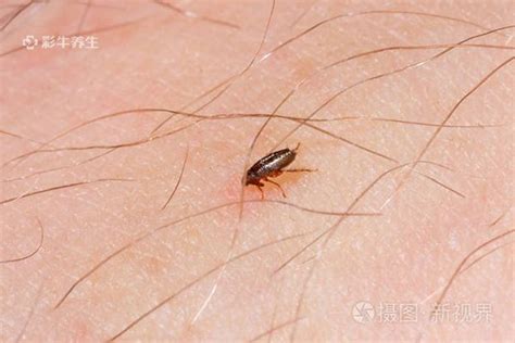 灭跳蚤及防治方法-上海帮庭环境科技有限公司