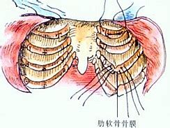鸡胸患者图片