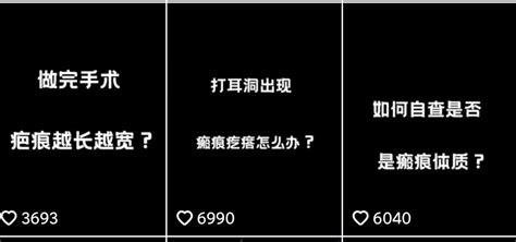 短视频内容的表现形式有哪些？4种常见短视频表现形式特点分析！ | 赵阳SEM博客