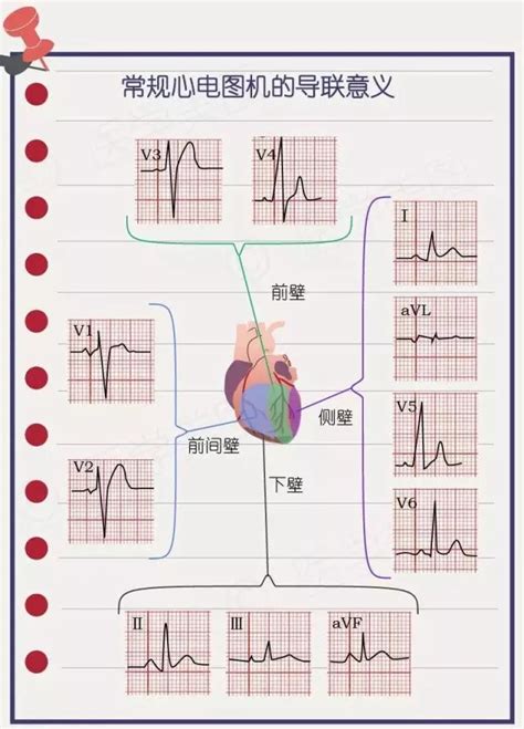 2021年临床执业医师考试实践技能心电图诊断考点一文速记！