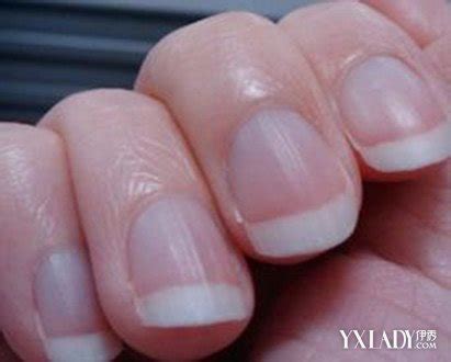 【图】指甲竖纹的成因 五大方法可调理(2)_指甲竖纹_伊秀美容网|yxlady.com