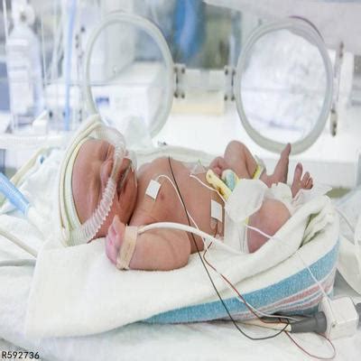 孩子早产了怎么护理护理早产宝宝的技巧须知_NYC纽约国际早教官网