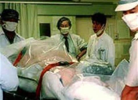 死得最痛苦的日本人：近距离遭受核辐射后，大夫坚持让他存活83天|核辐射|大内|日本人_新浪新闻