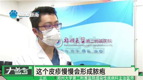 北京发现两例猴痘病例，科学了解猴痘病毒，医生：感染风险较低_腾讯视频