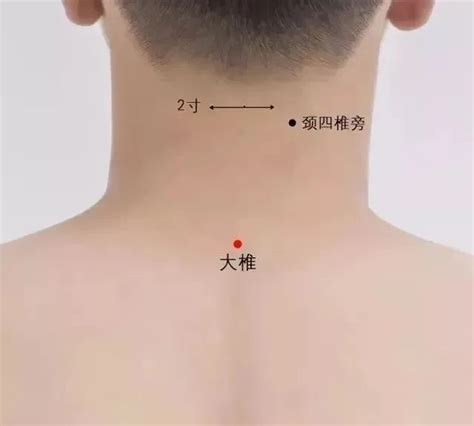 艾灸穴位图图片