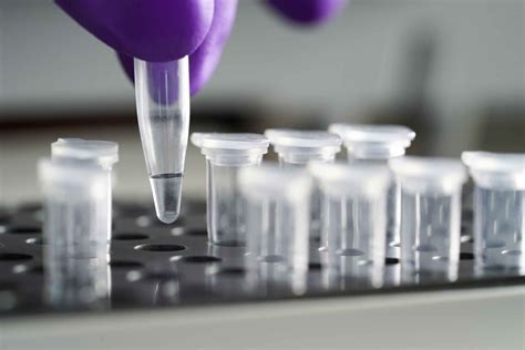 PCR-PCR技术-PCR实验前需要哪些准备