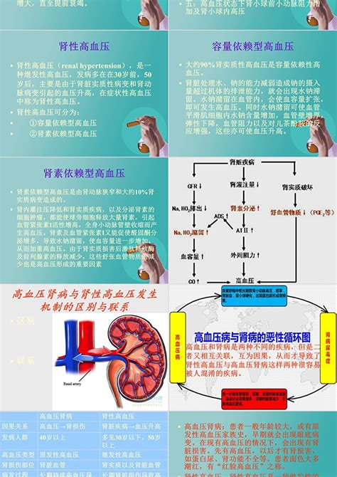 高血压肾病与肾性高血压发生机制的区别与联系PPT模板_卡卡办公