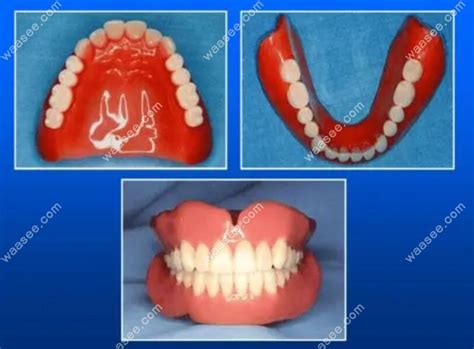 分享我制作活动义齿案例2（全口义齿）-英国假牙师的博客-KQ88口腔博客