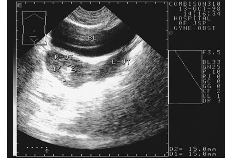 珠海超度流产婴儿的简单介绍