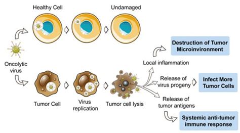 Progress in Lipid Research : 从癌症进展到治疗深入解读肿瘤微环境中的脂质-中科脂典
