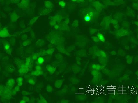 T24 [T-24] (人膀胱移行细胞癌细胞) (STR鉴定正确) - 武汉普诺赛生命科技有限公司 - 您身边的细胞专家【官方网站】