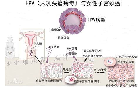 研究发现尿检可检HPV 准确性比宫颈抹片更高__凤凰网