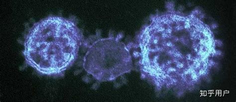 SARS-CoV-2病毒（新型冠状）有哪些症状，潜伏期发病期有多长时间？ - 知乎