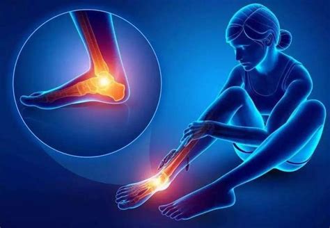 第五跖骨骨折，引起脚踝疼痛、肿胀，该怎么治疗呢？|踝关节|屈膝位|跖骨|脚踝|骨折|腓骨|-健康界