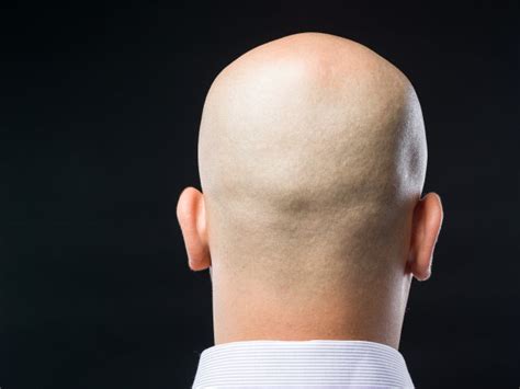 秃头,后脑勺,非全秃,头皮,剃光头,30到39岁,水平画幅,形状,在之后,白人摄影素材,汇图网www.huitu.com