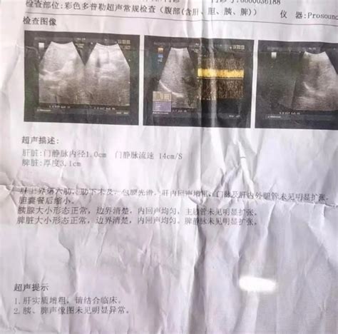 查肝功能要多少钱（肝功能检查单你会看吗） - 上海资讯网