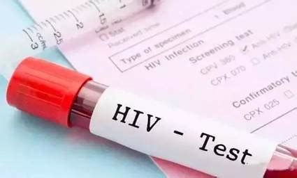 HIV艾滋病毒DNA核酸检测_艾滋病试纸_艾测网