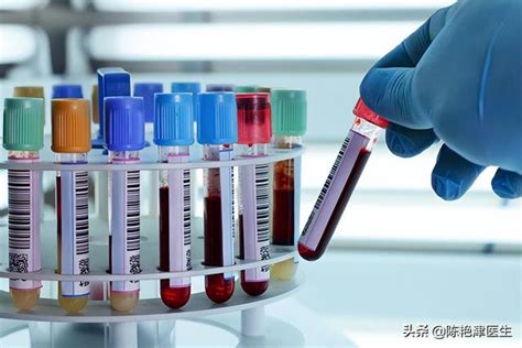 血生化检验单，如何快速看懂？_血浆