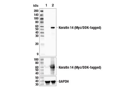 Keratin 14 Antibody | Cell Signaling Technology