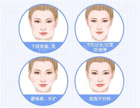 腮骨在哪个位置图图片