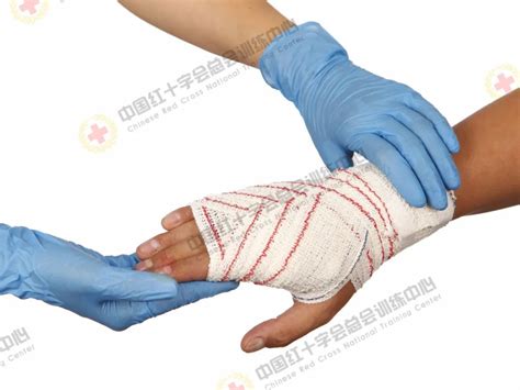 手腕受伤绷带图图片