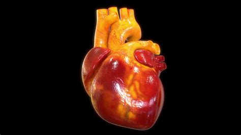 3D动画演示心脏主动脉瓣置换术，现代医学技术果真发达