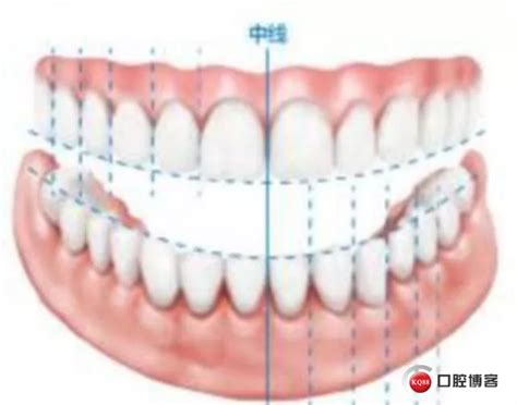 前牙美学修复（DSD+冠延长）-石峰的博客-KQ88口腔博客