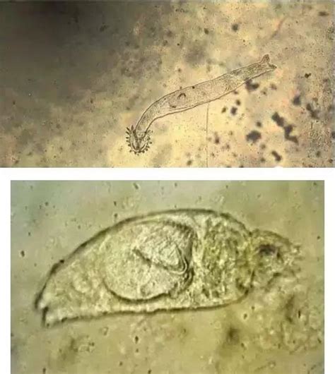 20种鱼类寄生虫图文病害收藏-中国鳗鱼网