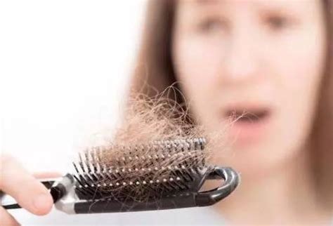 女性脱发的原因与治疗-发友网