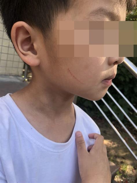上海一民办幼儿园多名孩子被生活老师划伤戳伤，园方：已开除-蓝鲸财经