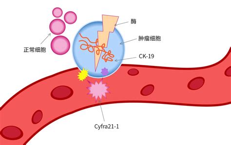 细胞角蛋白19(CK19)抗体免疫组化试剂盒品牌：GenomeMe中国-盖德化工网