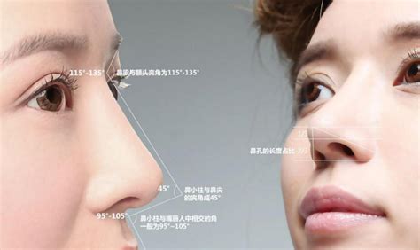 【图】盘点鼻子整形分几种 快速拥有高挺美鼻_鼻子整形分几种_伊秀美容网|yxlady.com