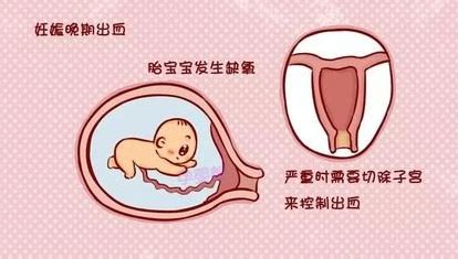 胎盘前置是什么意思（什么是前置胎盘？前置胎盘的孕妈妈怎样避免危险顺利生娃？） | 说明书网