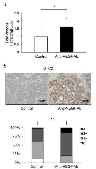 VEGF Receptor 2 (55B11) Rabbit mAb | Cell Signaling Technology