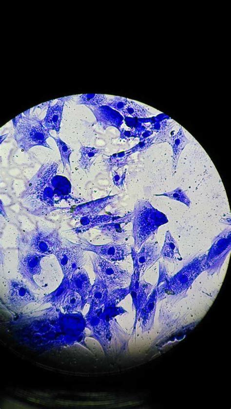 显微镜下可见白血细胞Leu图片素材-正版创意图片503473433-摄图网