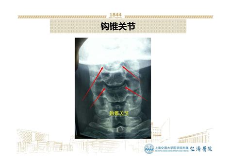 钩椎关节解剖图图片