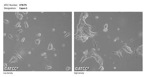 CACO2细胞（人结直肠腺癌细胞）培养注意事项-上海传秋生物科技有限公司