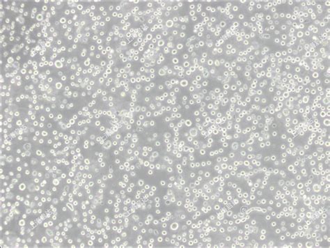 RPMI 8226 cell pellet - 1 million cells | cell pellet - 1 million cells ...