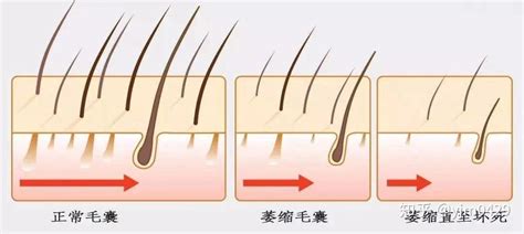 长沙岱高毛囊分析检测仪为你展示不同头皮头发的检测结果 - 前沿技术 - 毛毛网