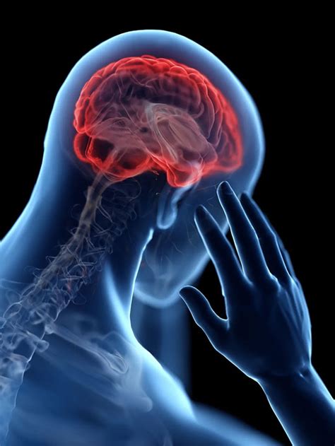 【脑健康月】脑血管疾病正在年轻化， 40岁以后的人更要多注意 - 知乎
